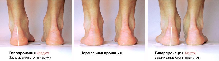 Как быстро бегать, чтобы похудеть и похудеть? Как заниматься на беговой дорожке, чтобы похудеть